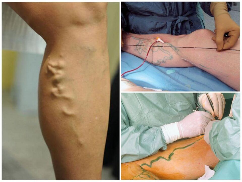 chirurgie